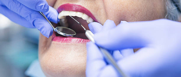 Best Emergency Dentist for Knocked-Out Tooth in Brewster, NY